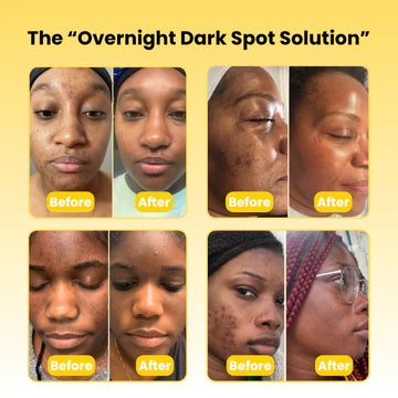 Awaken to Radiant Skin Every Morning!
